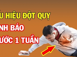 Dấu hiệu cảnh báo đột quỵ trước 1 tuần mà mọi người cần đặc biệt lưu ý